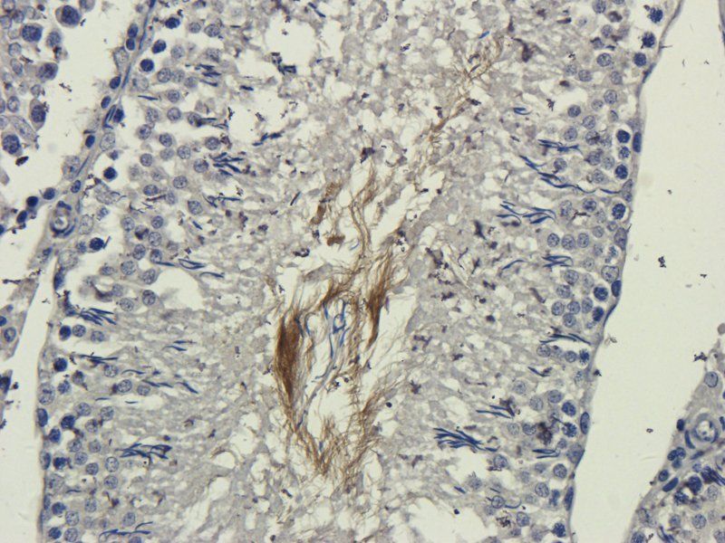 DEPDC1 antibody