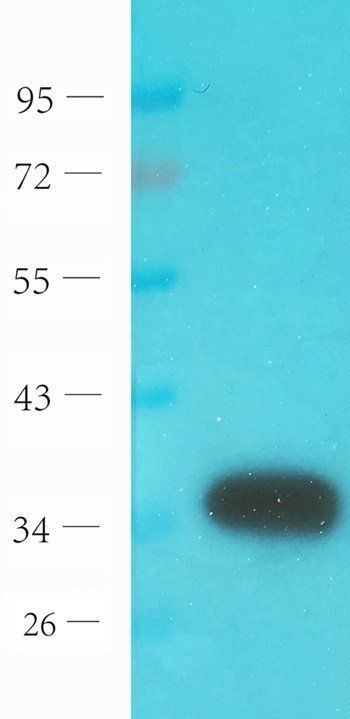 Der P1 antibody
