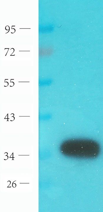 Der P1 antibody