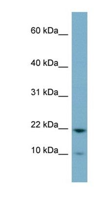 DESI1 antibody