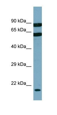 DESI2 antibody