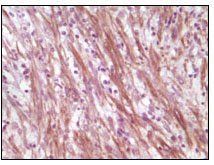 Desmin Antibody