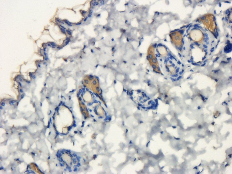 Desmocollin 1 Rabbit Polyclonal Antibody