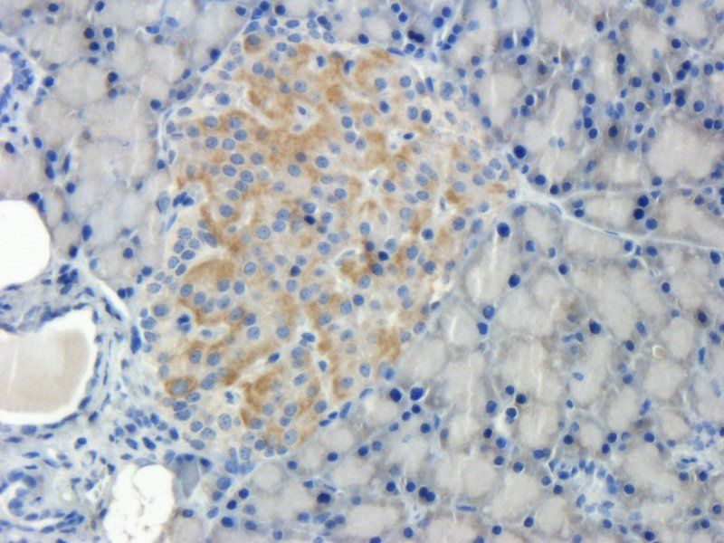 Desmocollin 1 Rabbit Polyclonal Antibody