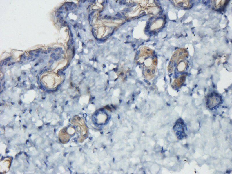 Desmocollin 1 antibody