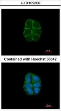 Desmoglein 2 antibody