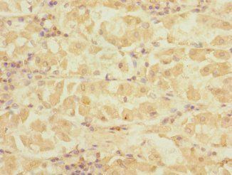 DET1 Antibody