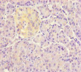 DET1 Antibody