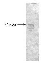 Dextranase antibody