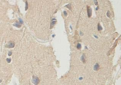 Anti-ITIH2 Antibody