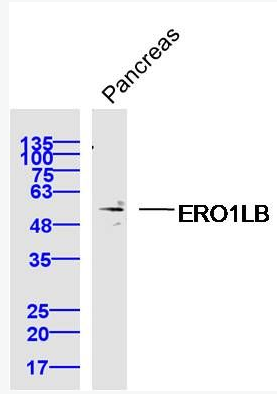 ERO1LB antibody