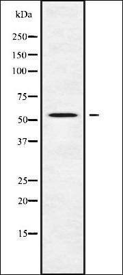 DFNA5 antibody