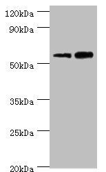 DFNA5 antibody