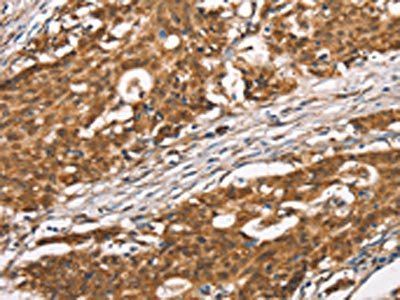 DGAT1 Antibody