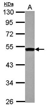 DGAT2 antibody