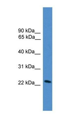 DGAT2L7P antibody