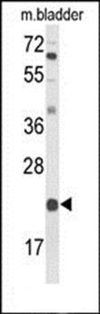 DGCR6 antibody