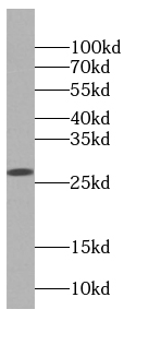 dGK antibody