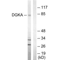 DGKA antibody