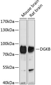 DGKB antibody