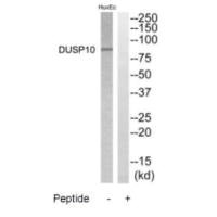 DGKB antibody