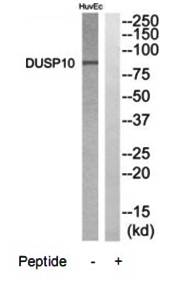DGKB Antibody