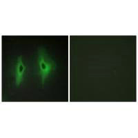 DGKH Antibody