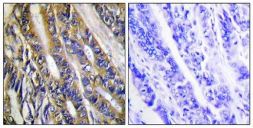 DGKH Antibody