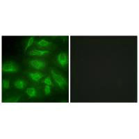 DGKI Antibody