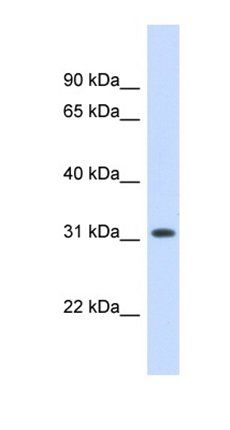 DHDDS antibody