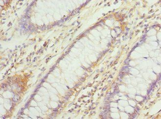DHDDS Antibody