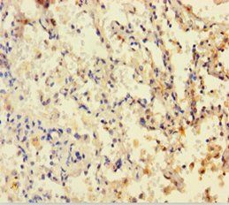 DHFR Antibody
