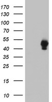 DHFRL1 (DHFR2) antibody