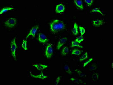 DHH Antibody