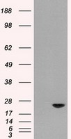 DHRS1 antibody