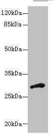 DHRS12 antibody