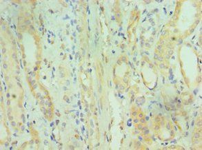DHRS2 Antibody