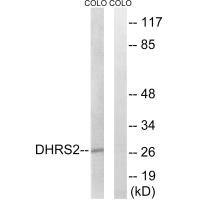 DHRS2 antibody