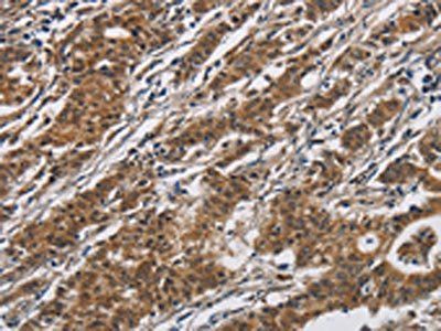 DHRS3 Antibody