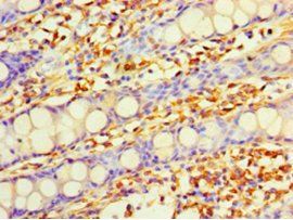 DHRS7 Antibody