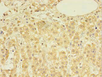 DHRSX Antibody