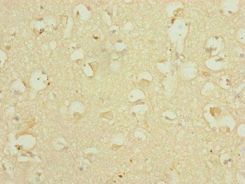 DHTKD1 Antibody