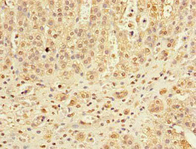 DHX30 Antibody