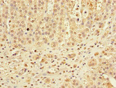 DHX30 antibody