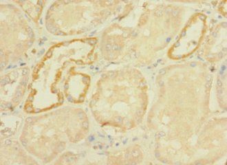 DHX32 Antibody