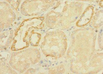 DHX32 antibody