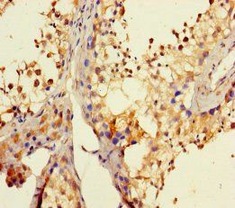 DHX35 Antibody