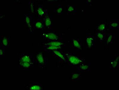 Di-methyl-HIST1H3A (K27) antibody