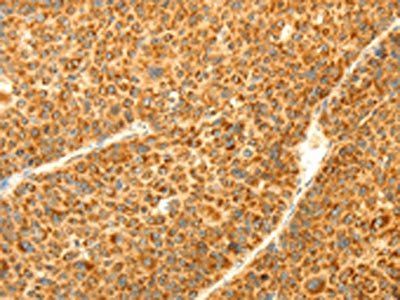 DIABLO Antibody