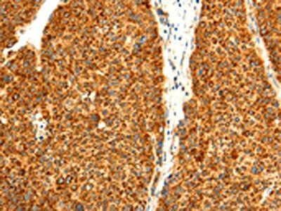 DIABLO Antibody